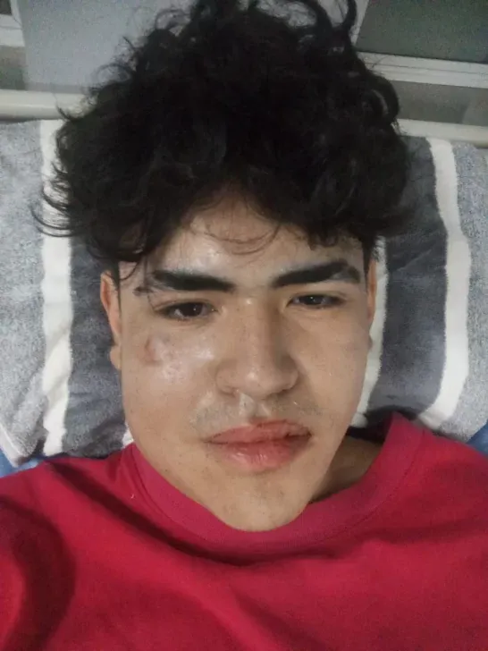 chico-546x728 chico-546x728