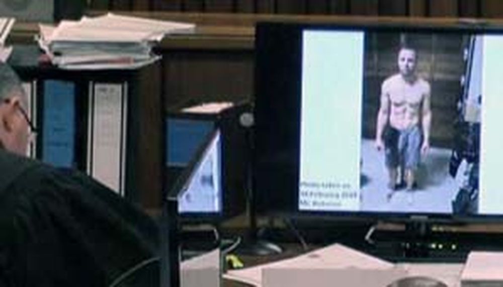 Pistorius, ensangrentado
