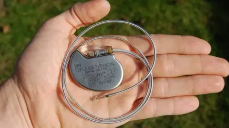 Procesaron a un médico por vender un marcapasos de PAMI a través de Mercado Libre