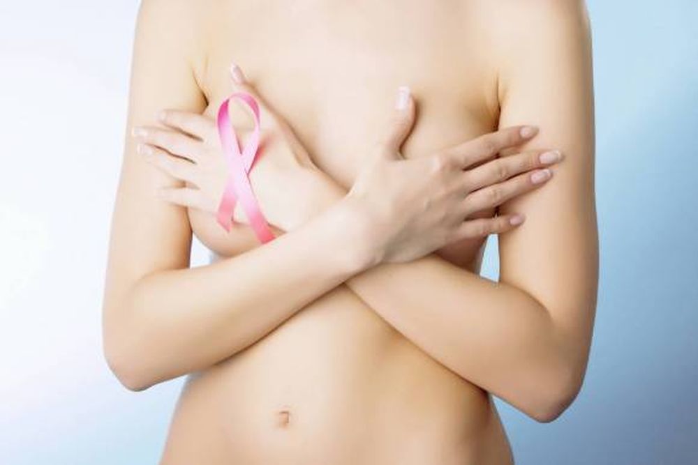 Radiografía del cáncer de mama