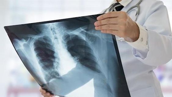 El programa de un sanjuanino y otros 6 investigadores para detectar  Covid-19 en 3 minutos