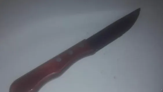 Le perforaron un ojo con un cuchillo en medio de una pelea
