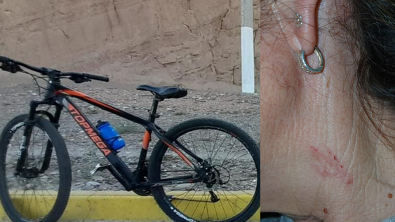 La bicicleta robada y cómo agredieron a la víctima.