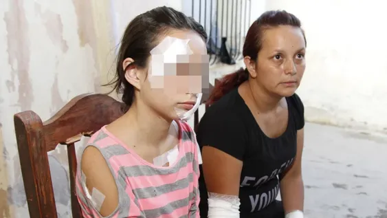 Cae el sujeto que casi mató en moto a una nena, no declaró