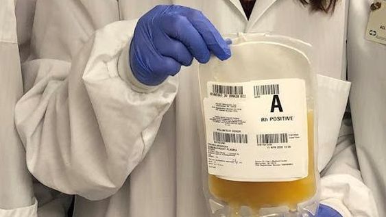 Las conclusiones de tres estudios argentinos sobre el plasma de convaleciente