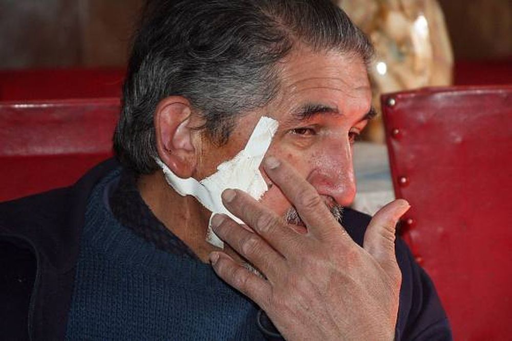 Asaltan a taxista, le tajean la cara y lo dejan en el baúl