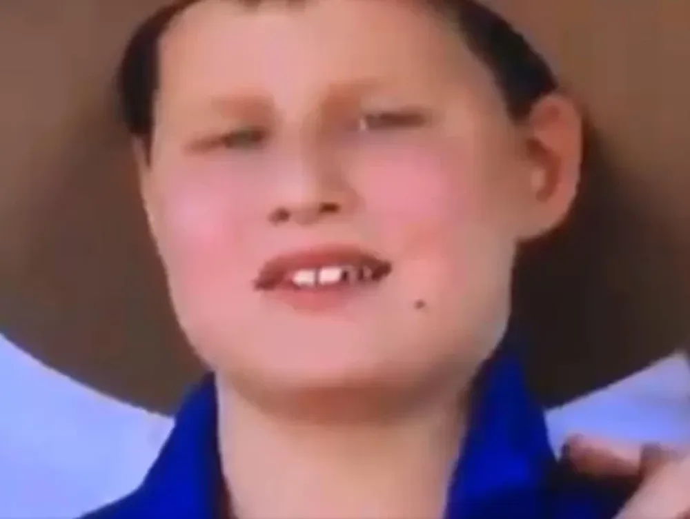 “El niño sapo” que se hizo viral por comer moscas durante una entrevista en televisión