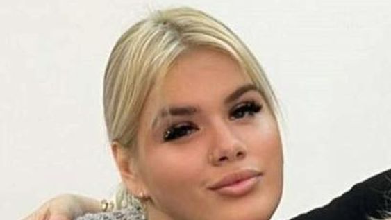 More Rial se hizo un retoque estético que dio que hablar: “Te queda como…”