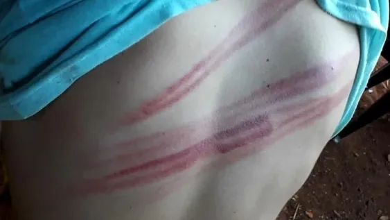 Volvía de la carnicería y fue azotado por un grupo de policías