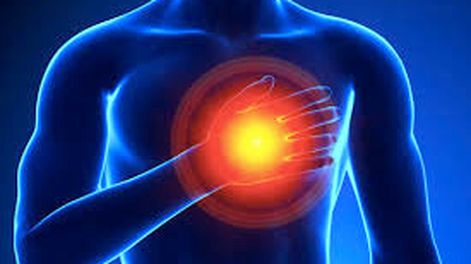 Más de 50 mil infartos por año y alta mortalidad en Argentina