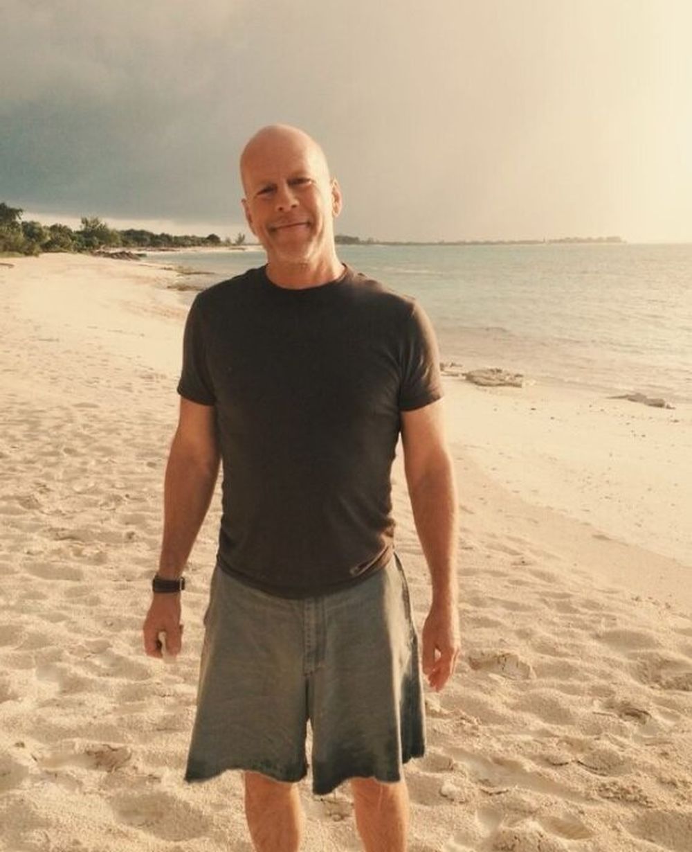 Qué es la demencia frontotemporal, el síndrome que le diagnosticaron a Bruce Willis