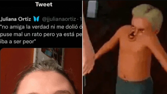 Tuvo un brote de alergia, se le deformó la cara y una amiga la hizo meme