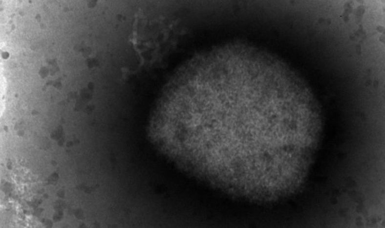 Detectaron el primer caso de viruela del mono en una mujer