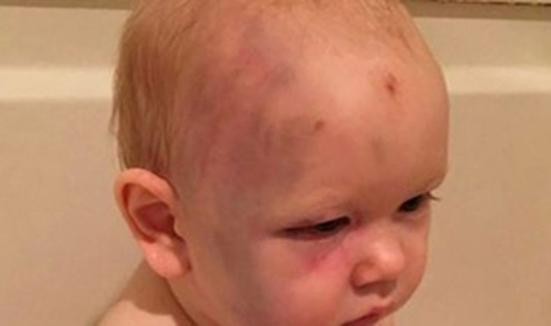 Niñera golpeó a un bebé pero no será detenida porque el nene no puede denunciarla