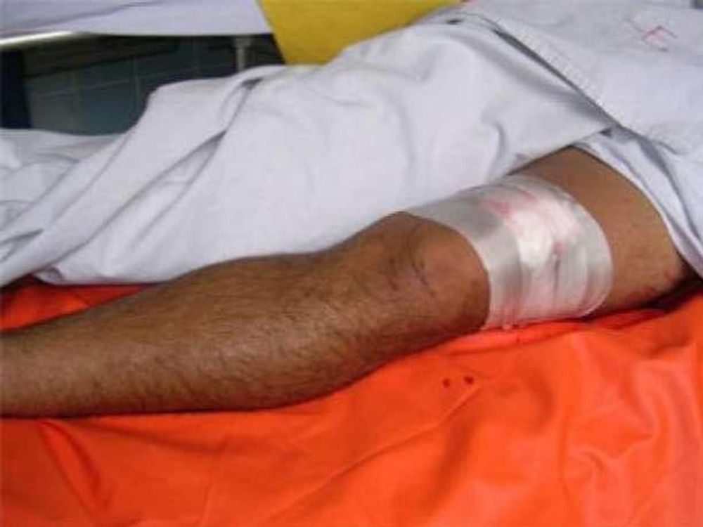 Un joven recibió un disparo en su pierna en medio de un confuso episodio