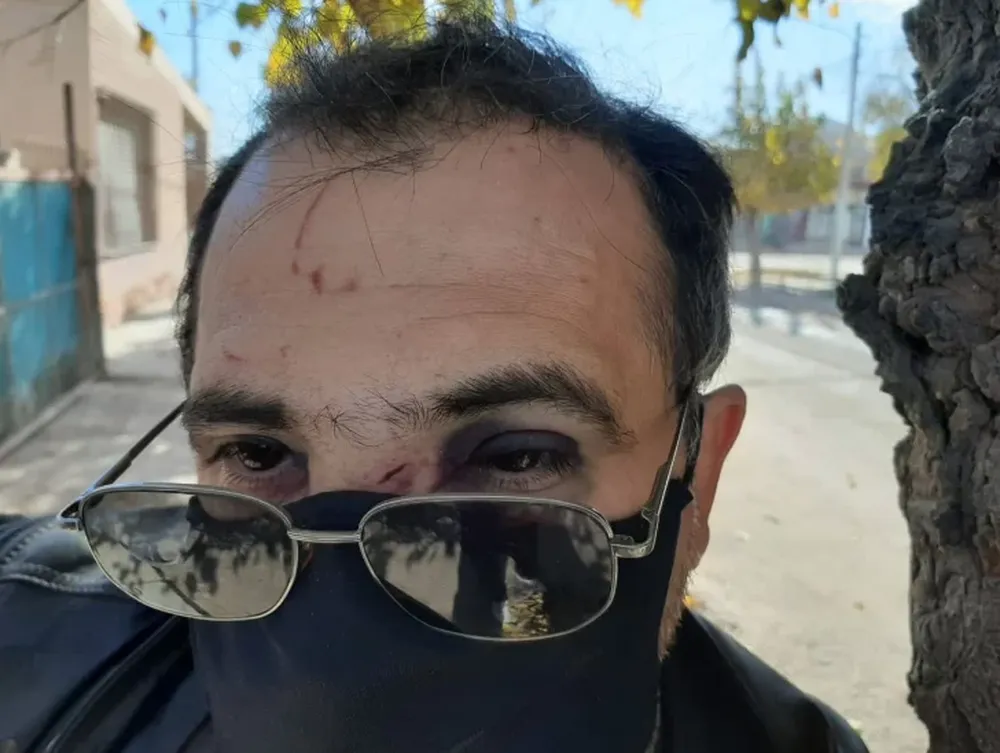 Entran dos a su taller, lo atacan a golpes y lo fracturan, ¿fueron a robar o por venganza?