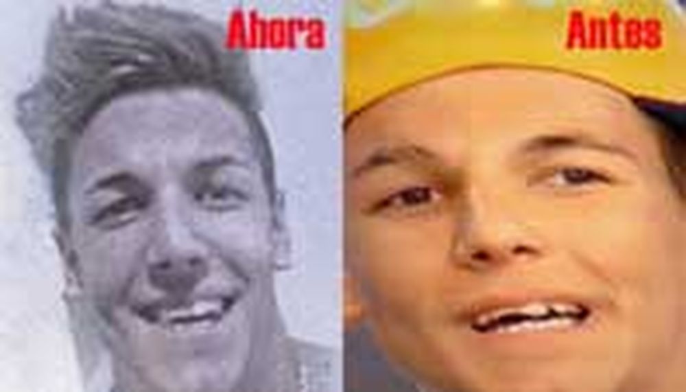 Se arregló los dientes