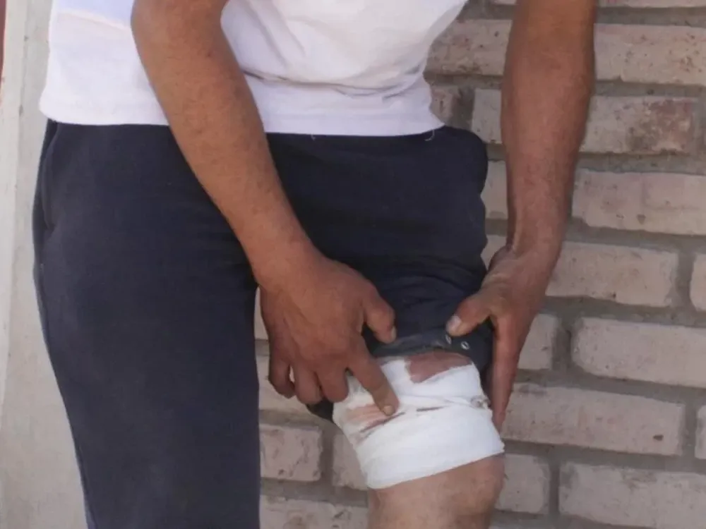 Dos heridos de arma de fuego en distintas grescas, casi en paralelo