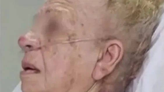 Jubilada de 93 años terminó grave por un terrible asalto