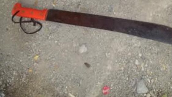 Un joven fue atacado con un machete en un intento de robo