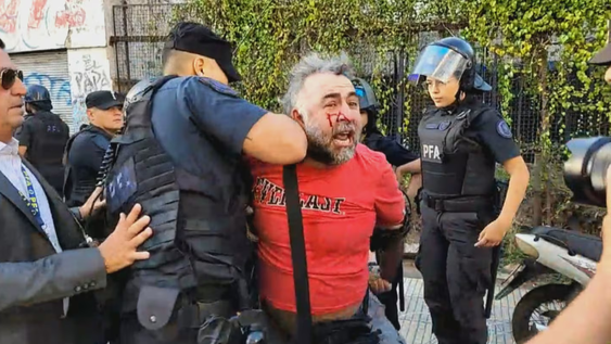 El momento que un camarógrafo es detenido después de ser agredido por la policía frente al Congreso Nacional.&nbsp;