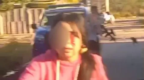 Una menor perdió el ojo tras ser herida con un arma no letal por un policía de Córdoba