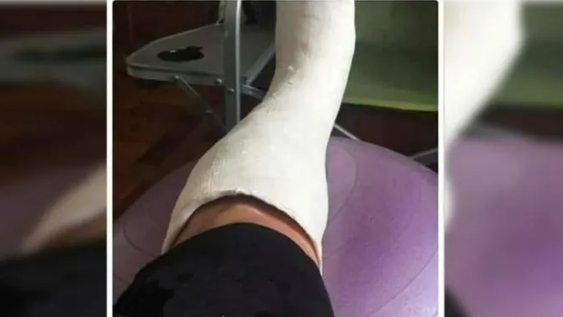 Increíble: ofrecen yesos truchos para faltar al trabajo y ver a la “Scaloneta”