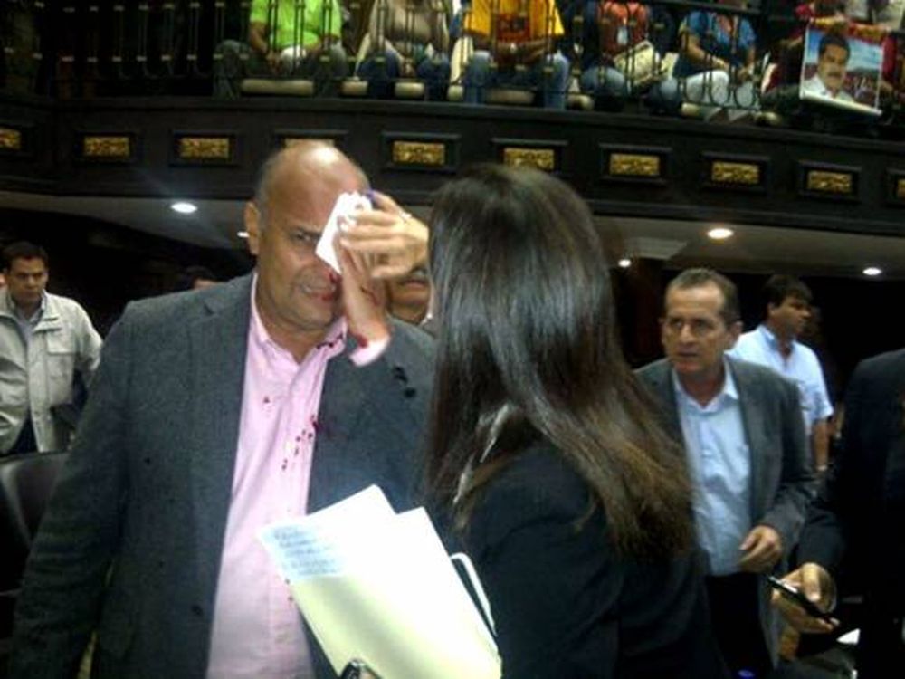 Golpean salvajemente a legisladores de Capriles