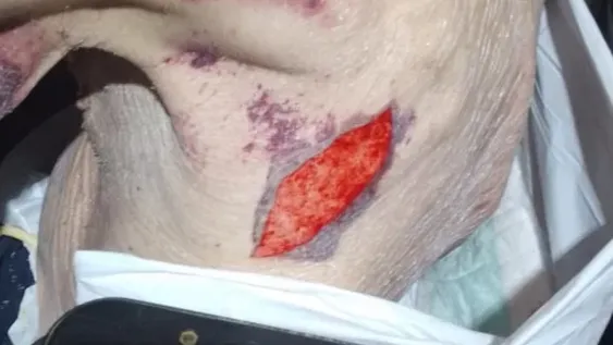 Tiene 80 años, vive en plena miseria y alarma su calamitoso estado de salud