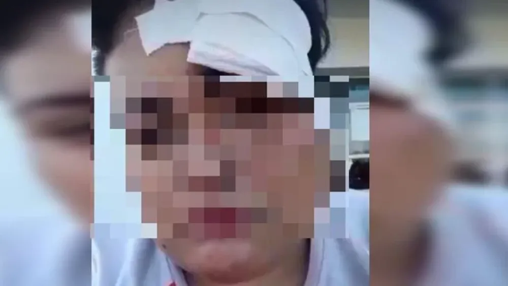 Una mujer fue golpeada por 5 hombres por ser lesbiana