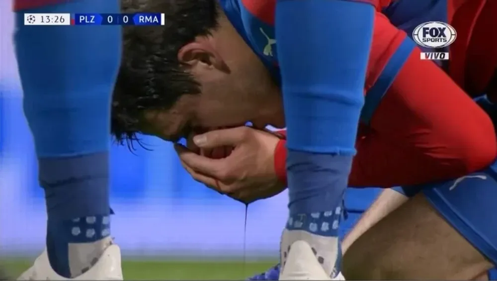 El video del codazo de Ramos que hizo sangrar a Milan Havel