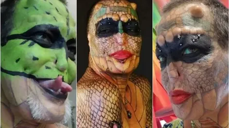 Se extirpará los genitales para completar la transformación a “dragón sin género”