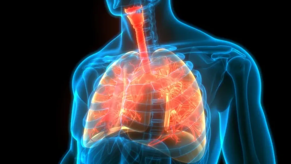 Fibrosis Pulmonar Idiopática, el gran desafío del diagnóstico temprano