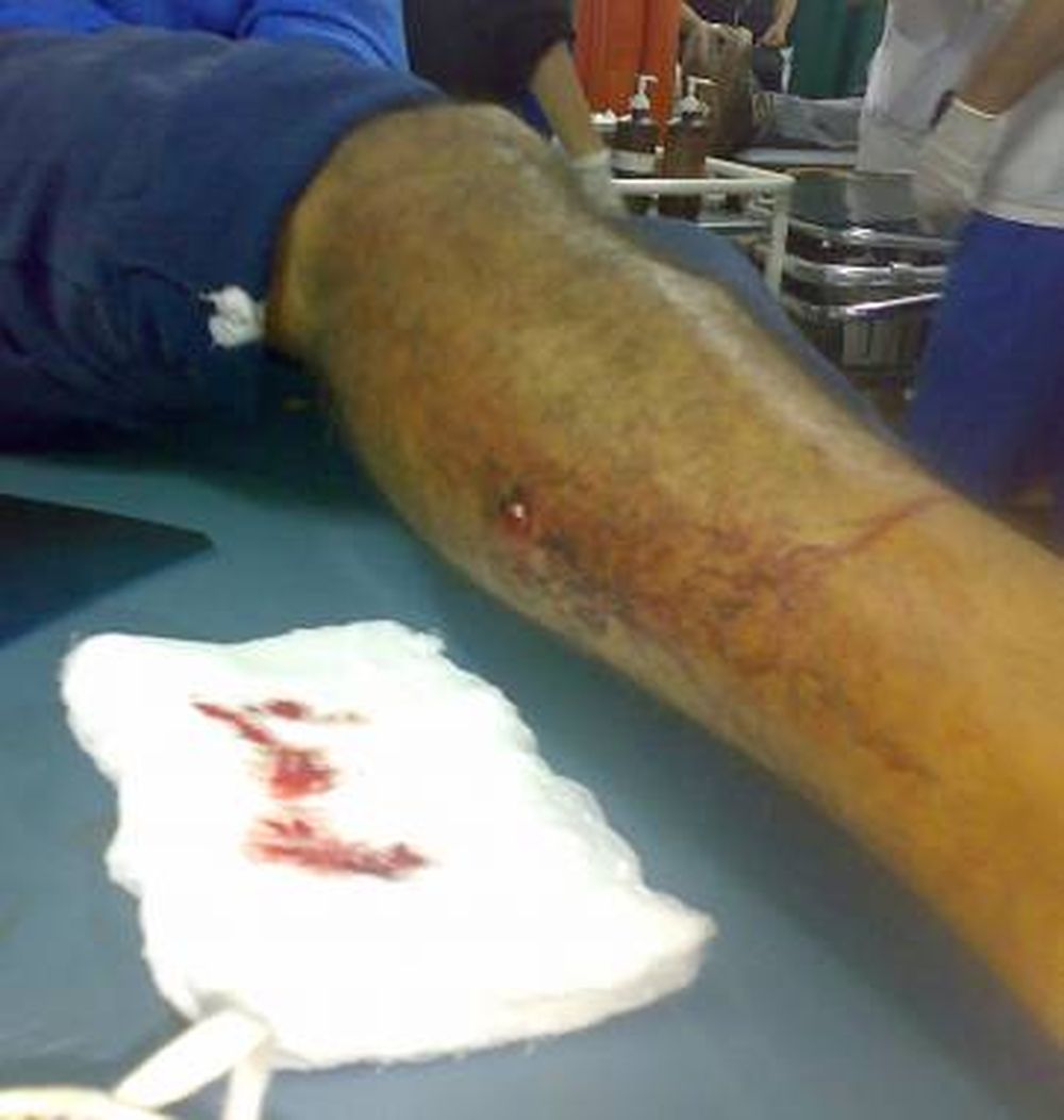 Liberaron al policía que baleó a un joven