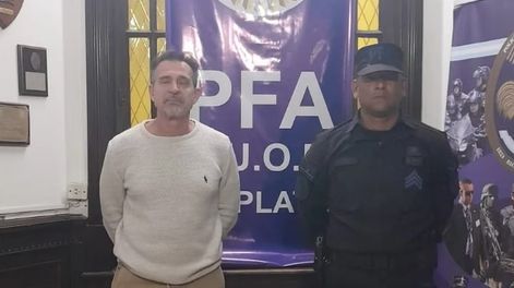 Las alarmantes fotos de la esposa de Lotocki en microbikini que demostrarían los daños del metacrilato