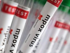 confirman el primer caso de viruela del mono en argentina confirman el primer caso de viruela del mono en argentina