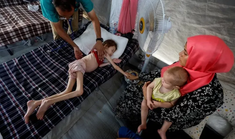 Una enfermera contó la cruda realidad de la hambruna en Gaza