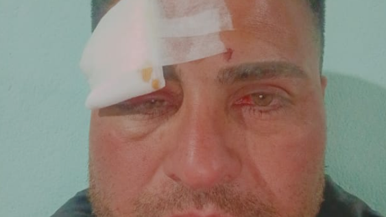 Agredieron brutalmente a un jugador de fútbol en medio de una cancha sanjuanina