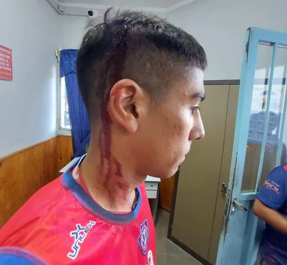 Violentos incidentes: jugadores de Villa Hipódromo fueron agredidos tras ganarle a Del Bono