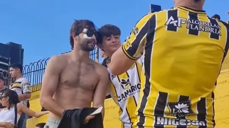 Santiago Sosa mostró cómo quedó su rostro tras la operación por la fractura que sufrió por un golpe de Marcos Rojo