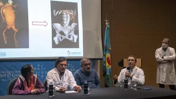 Inédito reemplazo total de aorta abdominal