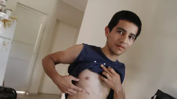 Enfrentó a dos ladrones que querían su bici y casi lo matan de un puntazo en el pecho