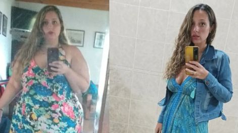 Bajó 100 kilos y es viral en TikTok con su antes y después