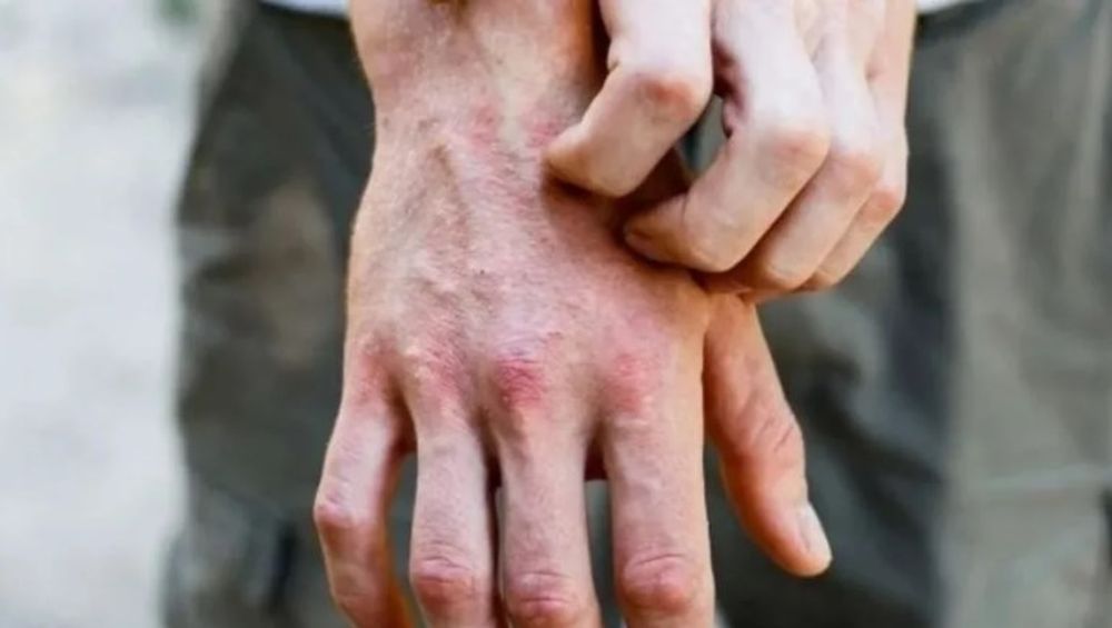 La forma de tu dedo meñique revelará aspectos desconocidos de tu personalidad