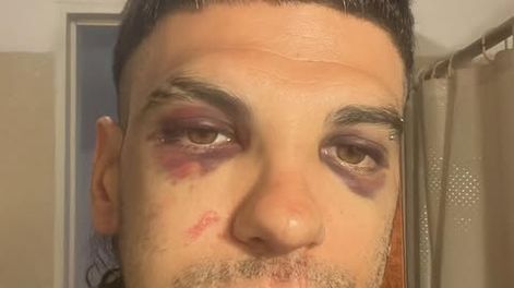 El empresario Juan Salvalaggio tras la golpiza.