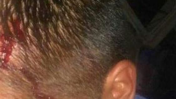 Le dieron un ladrillazo en la cabeza para robarle