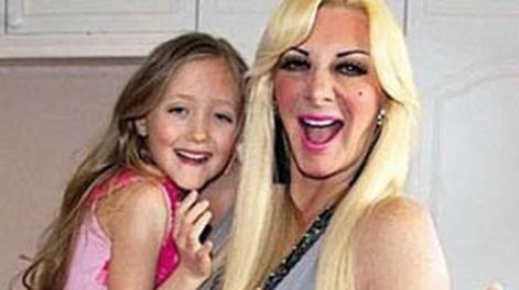 Botox a los 8 años