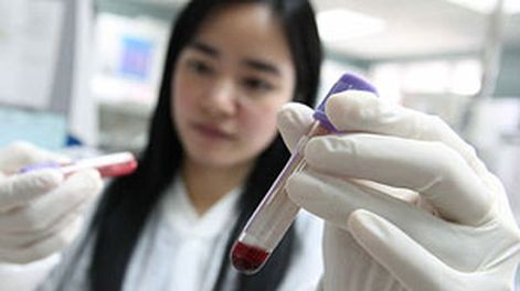 Crean un test que detecta el cáncer o VIH a simple vista