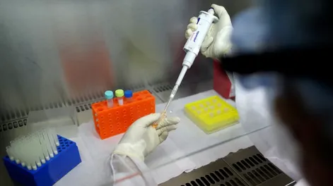 Confirmaron el primer caso de viruela del mono en el país sin antecedentes de viaje