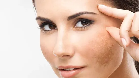 El ABC de las manchas